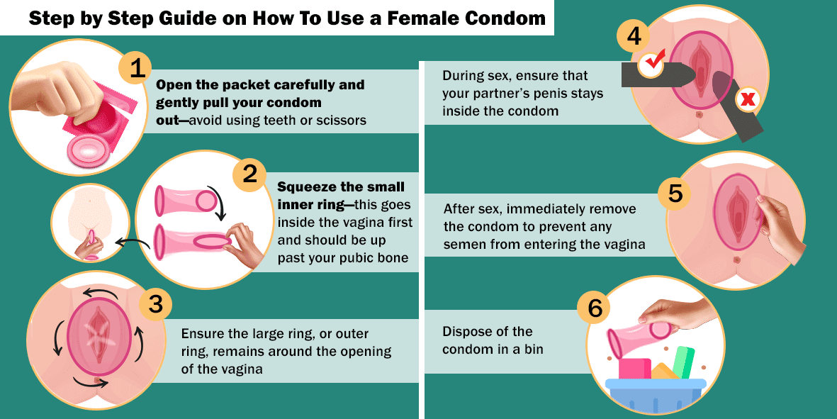 female-condom